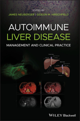 Autoimmune Liver Disease - Management and Clinical  Practice