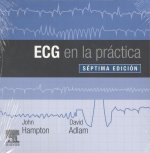 ECG EN LA PRÁCTICA