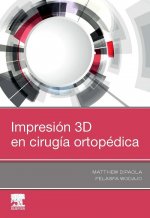 IMPRESIÓN 3D EN CIRUGÍA ORTOPÈDICA