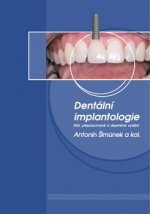 Dentální implantologie, 3. přepracované a doplněné vydání