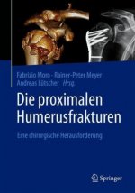 Die proximalen Humerusfrakturen