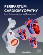 Peripartum Cardiomyopathy