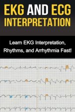EKG and ECG Interpretation