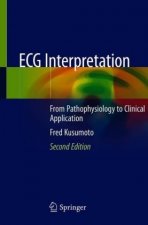 ECG Interpretation