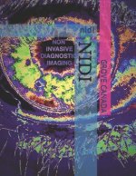 Nidi: nidi