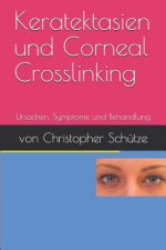 Keratektasien, Corneal Crosslinking: Ursachen, Symptome Und Behandlung
