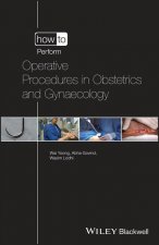 How to Perform Operative Procedures in Obstetrics and Gynaecology