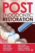 Post Endodontic Restoration