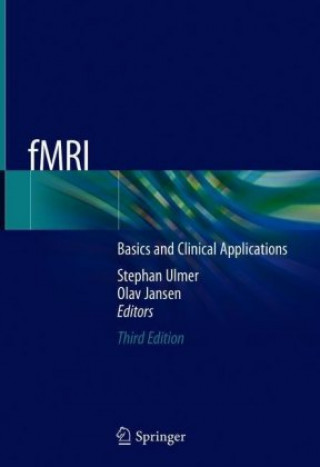 fMRI