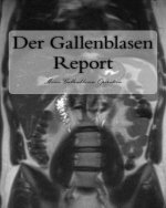 Der Gallenblasen Report: Meine Gallenblasen Operation