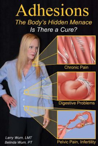 Adhesions: The Body's Inner Menace - Is There a Cure?