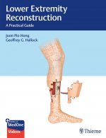 Lower Extremity Reconstruction