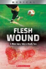 Flesh Wound (Xbooks): A Minor Injury Takes a Deadly Turn