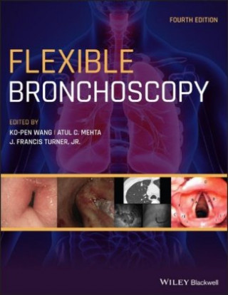Flexible Bronchoscopy 4e