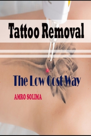 Tattoo Removal: The Low Cost Way