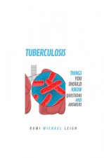 Tuberculosis