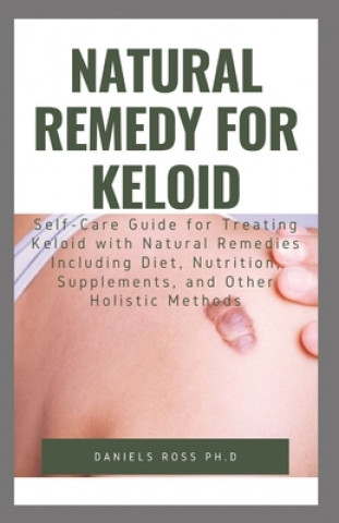 Natural Remedy for Keloid: What Your Doctor Will Not Tell You and Secret of Living a Keloid Free Life