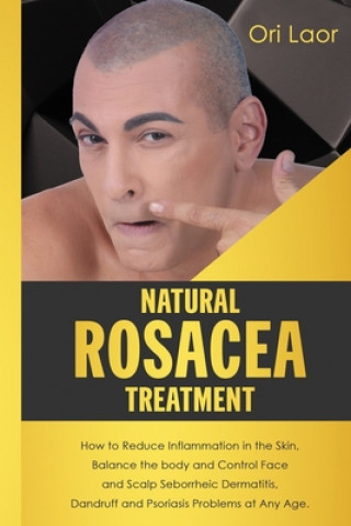 Natural Rosacea Treatment: How to Reduce Inflammation in the Skin, Balance the body and Control Face and Scalp Seborrheic Dermatitis, Dandruff an