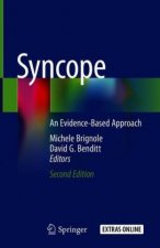 Syncope