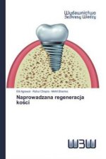 Naprowadzana regeneracja ko?ci