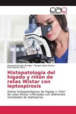 Histopatología del hígado y ri?ón de ratas Wistar con leptospirosis