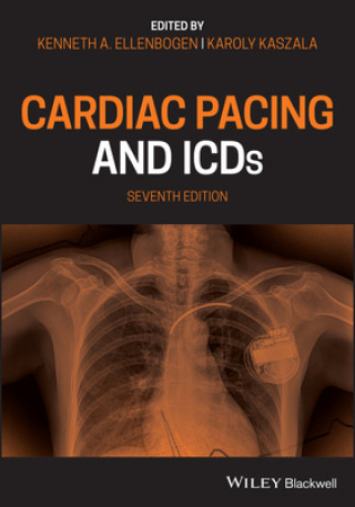 Cardiac Pacing and ICDs 7e