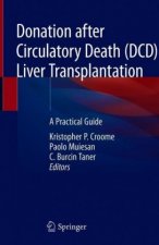 Donation after Circulatory Death (DCD) Liver Transplantation