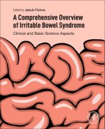 Comprehensive Overview of Irritable Bowel Syndrome
