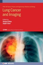 Lung Cancer and Imaging