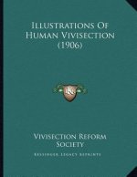 Illustrations Of Human Vivisection (1906)