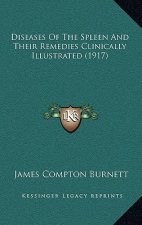 Diseases Of The Spleen And Their Remedies Clinically Illustrated (1917)
