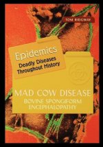 Mad Cow Disease: Bovine Spongiform Encephalopathy