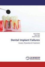 Dental Implant Failures