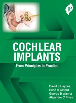 Cochlear Implants