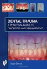 Dental Trauma