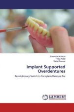 Implant Supported Overdentures