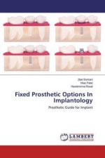 Fixed Prosthetic Options In Implantology