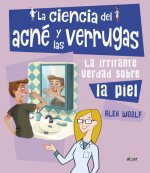 La ciencia del acné y las verrugas