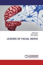 Lesions of Facial Nerve