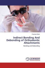 Indirect Bonding And Debonding of Orthodontic Attachments