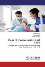 Class III malocclusion and Cleft