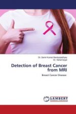 Detection of Breast Cancer from MRI