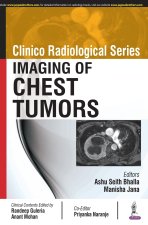 Clinico Radiological Series: Imaging of Chest Tumors