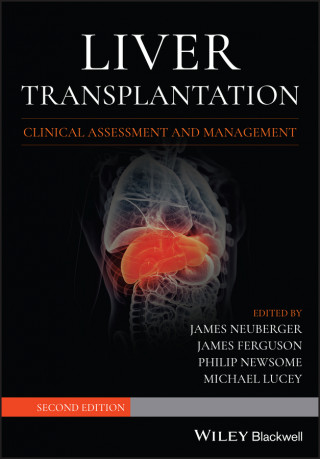 Liver Transplantation - Clinical Assessment and Management, 2nd edition