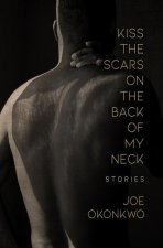 Kiss the Scars on the Back of My Neck: Stories