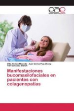 Manifestaciones bucomaxilofaciales en pacientes con colagenopatias