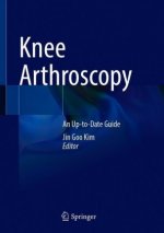 Knee Arthroscopy