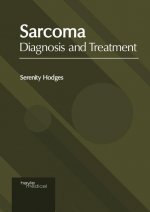 Sarcoma: Diagnosis and Treatment