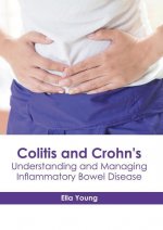Colitis and Crohn's: Understanding and Managing Inflammatory Bowel Disease