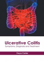 Ulcerative Colitis: Symptoms, Diagnosis and Treatment